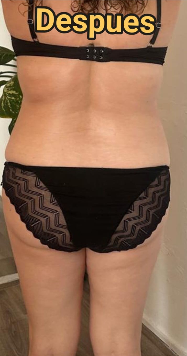 Después del tratamiento de moldeado de cintura